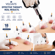 Velvats™ Revora – At-Home Cupping Set